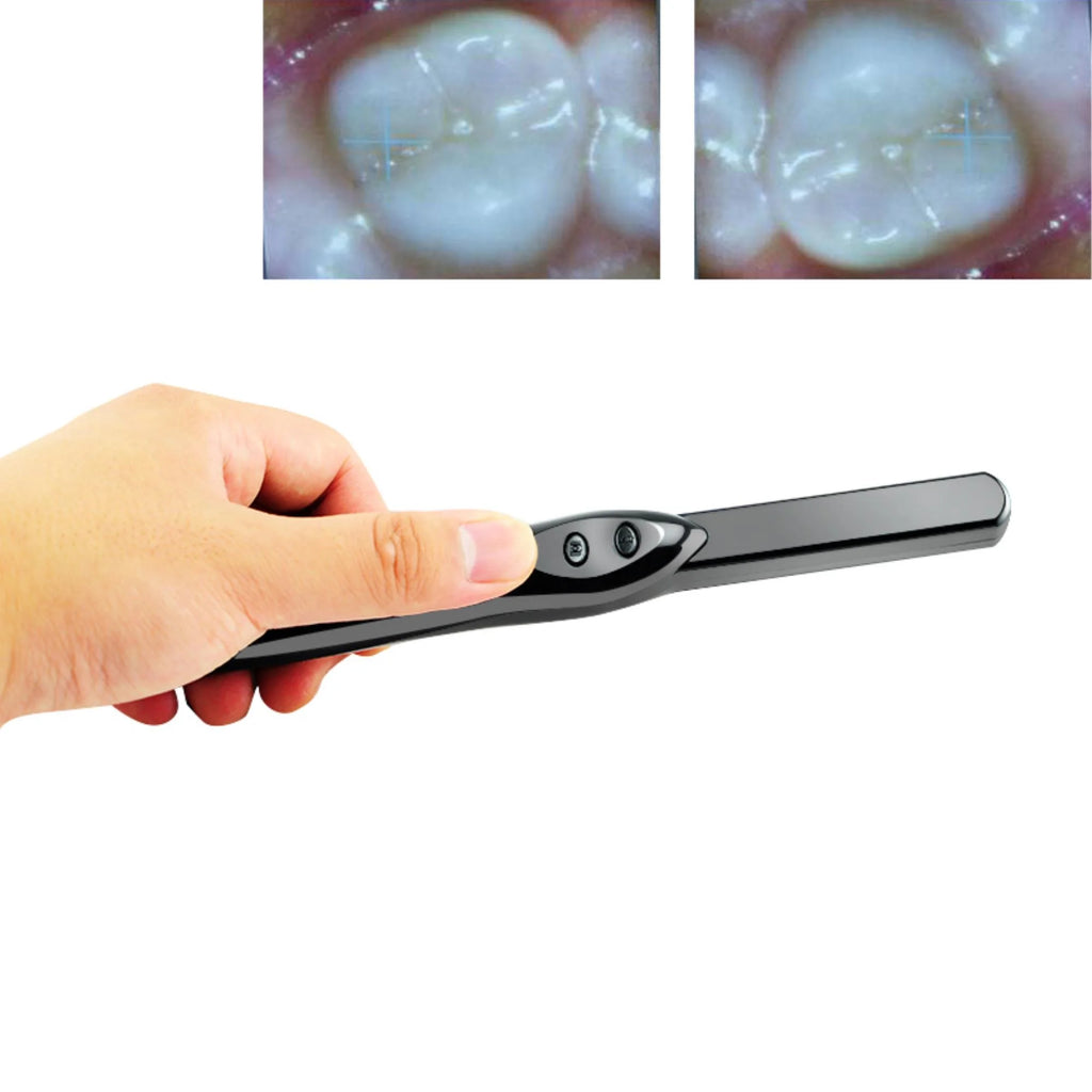6MP 6-LEDs USB 2.0 Dental Intraoral Camera O28020